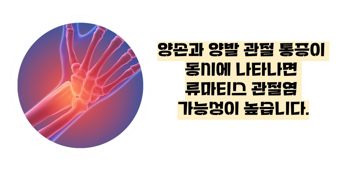 류마티스 관절염 초기증상