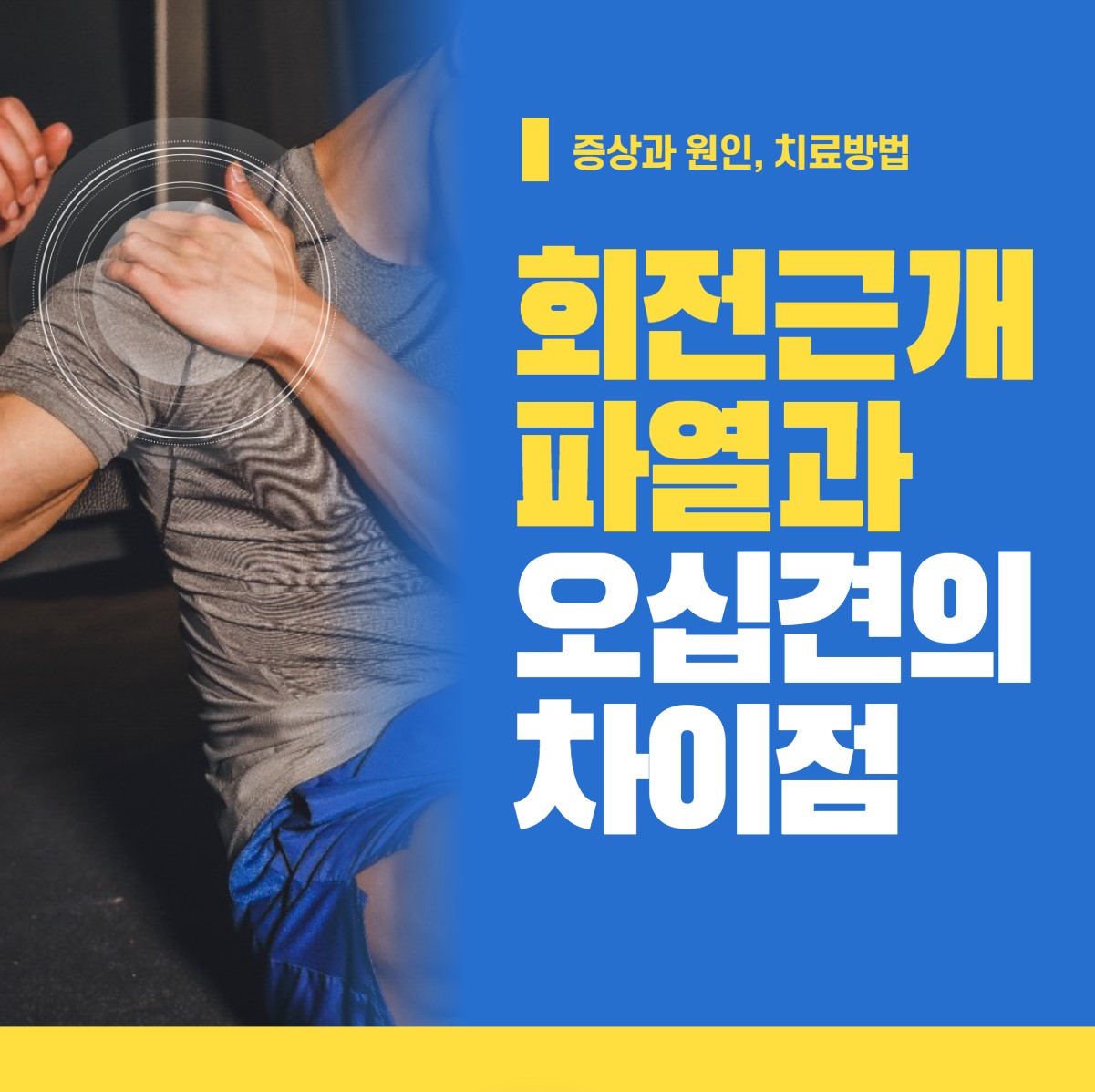 회전근개-파열과-오십견의 차이점,증상과-원인, 치료방법