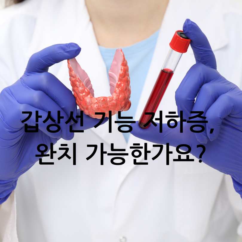 갑상선 기능 저하증 증상과 식이요법, 완치방법