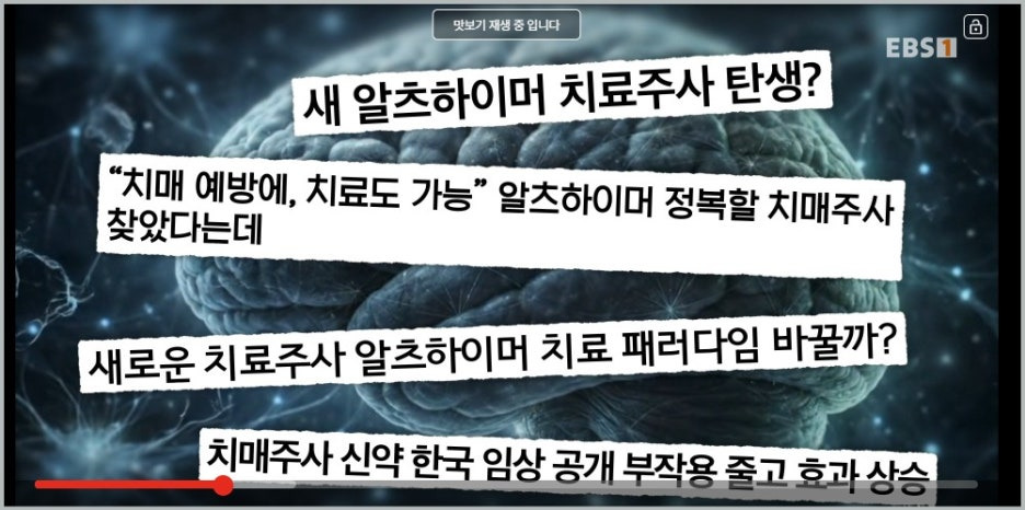 최성혜교수 EBS 명의 알츠하이머 치매 신경과 병원 치료방법