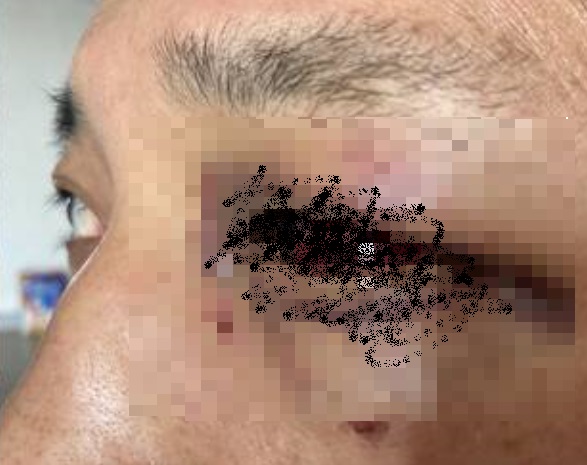 군산시의원 폭행