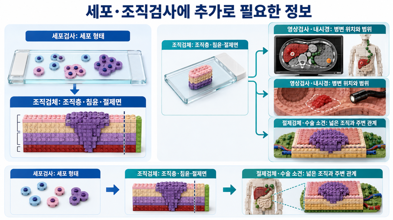 세포 형태와 조직층&middot;침윤&middot;절제면, 영상검사&middot;내시경의 병변 범위, 절제검체와 수술 소견의 추가 정보를 연결한 의료 인포그래픽