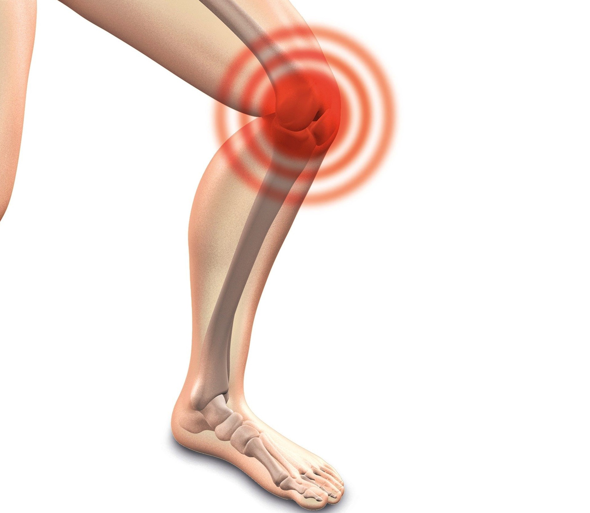 계단이 무릎을 망친다는 말, 진짜일까?