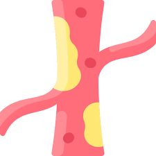 나쁜콜레스테롤 낮추는 방법