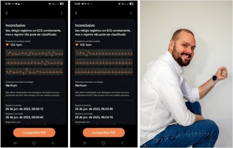 삼성 스마트워치