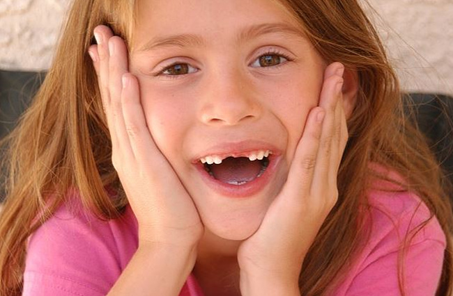 앞니가 빠진 사진