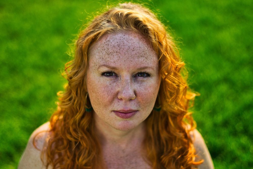 디페린-바른-여자