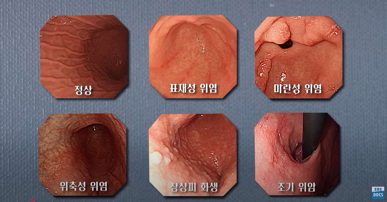  EBS 귀하신몸