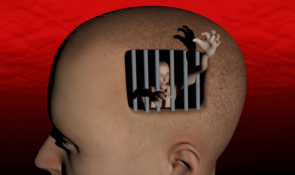 젊은 치매-원인