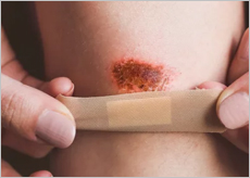 알부민 수치가 낮으면 나타나는 신호