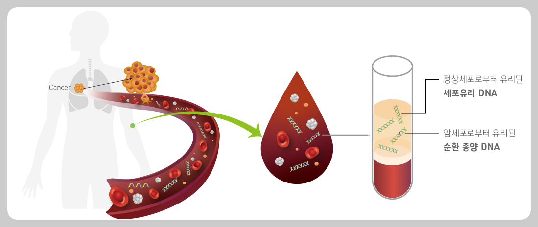 다양한 암종을 혈액으로 검사하는 아이캔서치&reg; 검사