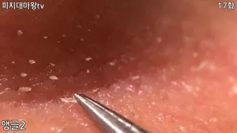 남자 얼굴 피지 제거 화장품 꿀템_16