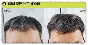 탈모 1위샴푸 그래비티 사용횟수 안내