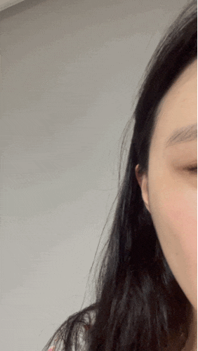 측두근 보톡스 후기