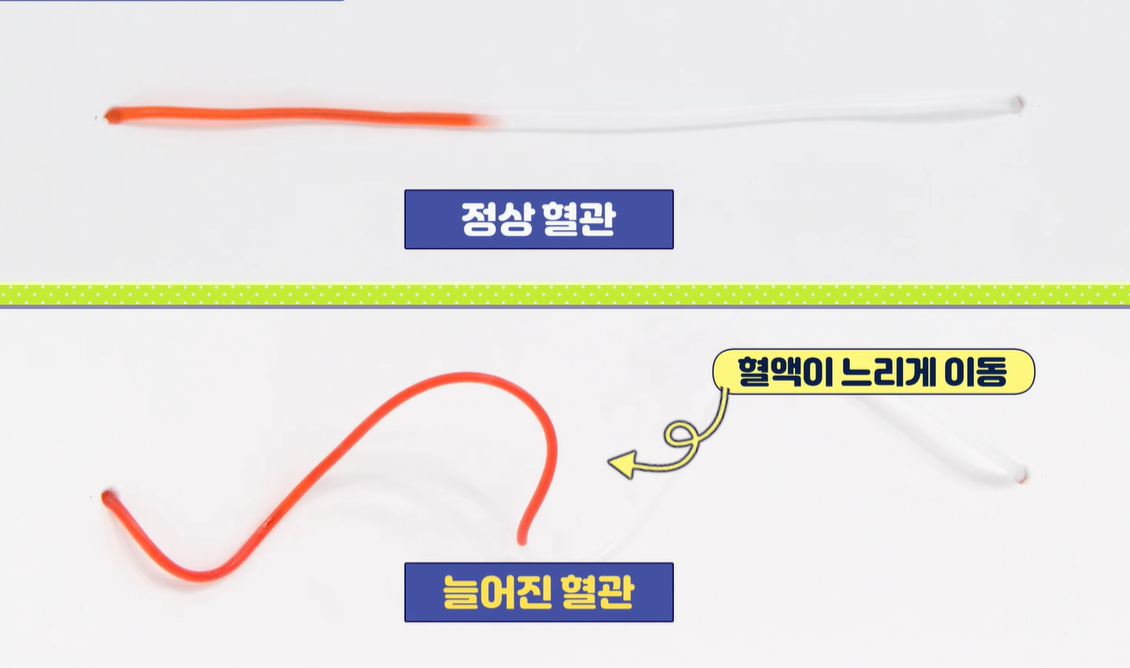 엘라스틴 효능