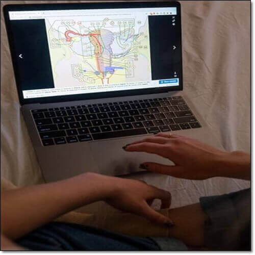 난소낭종 파열 원인