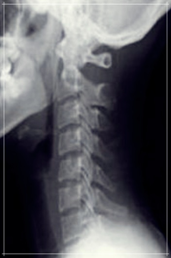 역 C자목 교정베개, 정말 효과가 있을까?