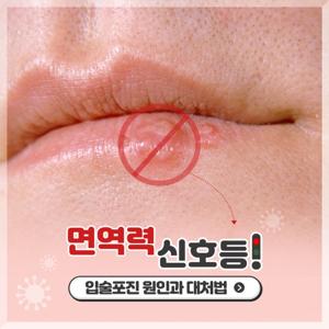 입술헤르페스(구순포진)란?