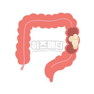 분변 잠혈검사 양성