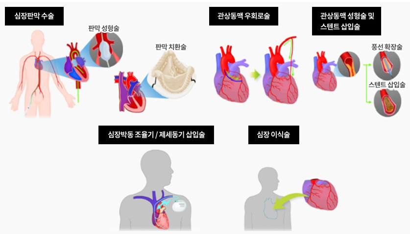 심부전 관리: 증상부터 치료까지 알아야 할 모든 것