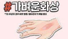 상처별 응급처치 방법