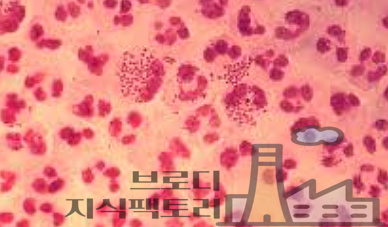 요도 간지러움