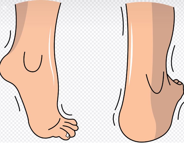 족저근막염 통증