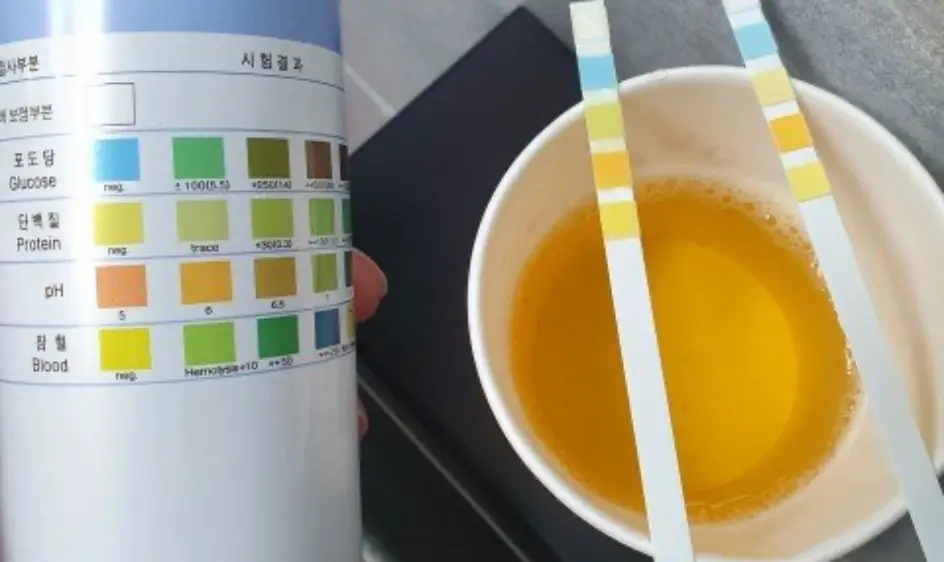 단백뇨 증상과 원인
