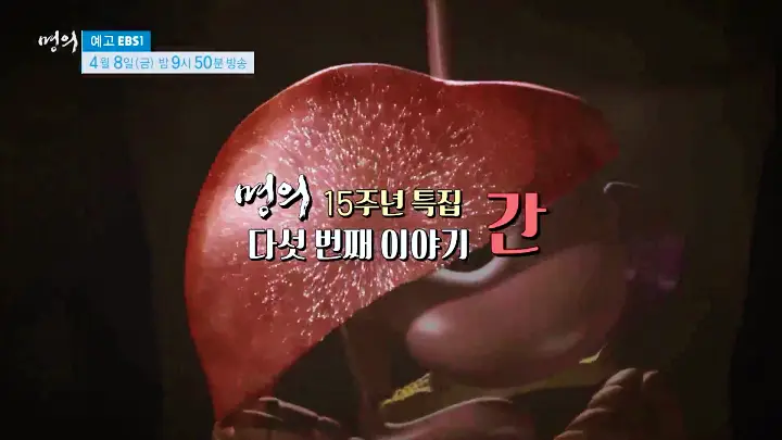 명의 간이식 간암 알프스수술 간경변 간암 간경화 간염 바이러스 전문의 서경석 김기훈 임영석 교수 진료 예약 소개