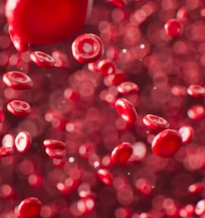 고지혈증 증상 원인 예방법 음식