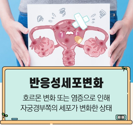 반응성세포변화 자궁경부암 신호일까 원인 관리