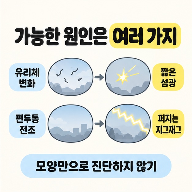유리체 변화의 짧은 섬광과 편두통 전조의 퍼지는 지그재그를 비교하고 모양만으로 진단하지 말라고 설명한 도식