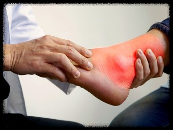 극심한 고통의 통풍