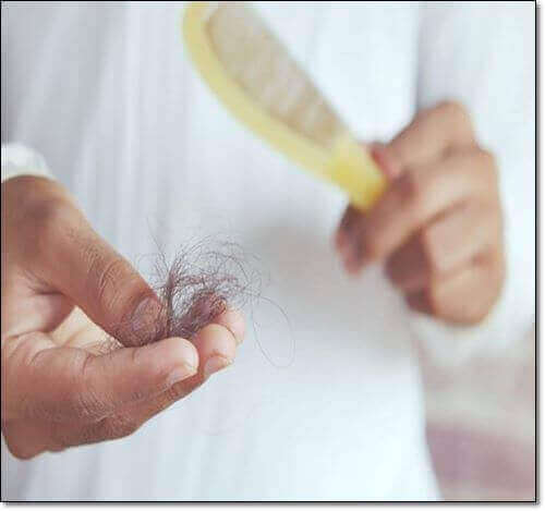 피마자오일 탈모 방지 효과