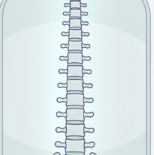 허리디스크 증상