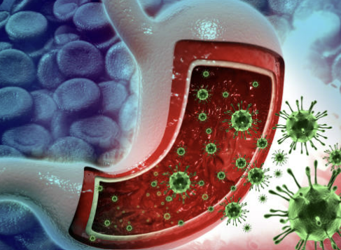 장염 증상 빨리낫는법 장염에 좋은 음식 등 알아보기 (최신 Ver)