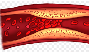 고지혈증에 좋은 영양제