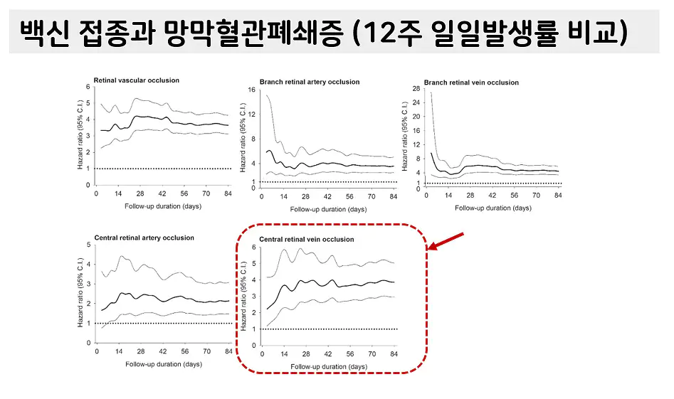 망막혈관폐쇄증 코로나 백신 부작용 논문, 이덕희 경북의대 교수