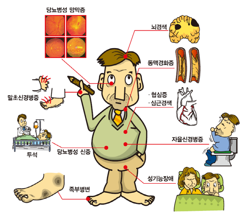 당뇨 초기증상 병원