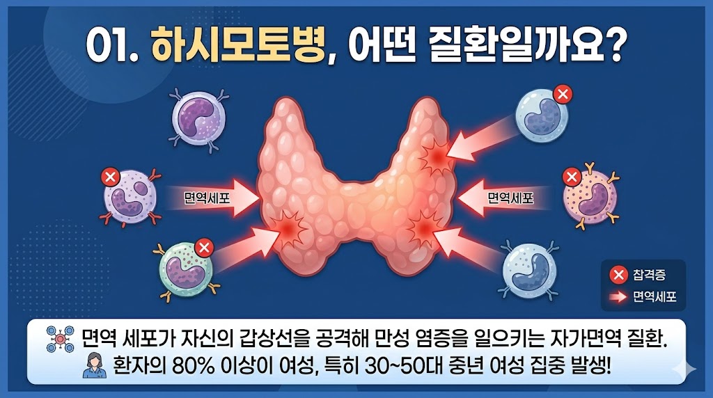 면역 세포가 갑상선을 공격하는 과정을 나타낸 하시모토 갑상선염 정의 인포그래픽