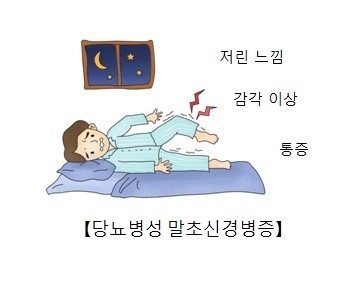 당뇨병성 신경병증