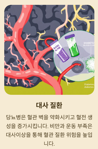 뇌경색의 원인
