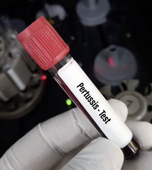 Nano-LC-MS/MS를 활용한 극미량 희귀 질환 치료제 모니터링 플랫폼_ 소량 시료 기반 초고민감 분석법 개발과 환자군 치료 반응성 모니터링 전략