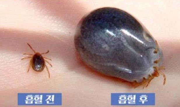 SFTS 감염 증상