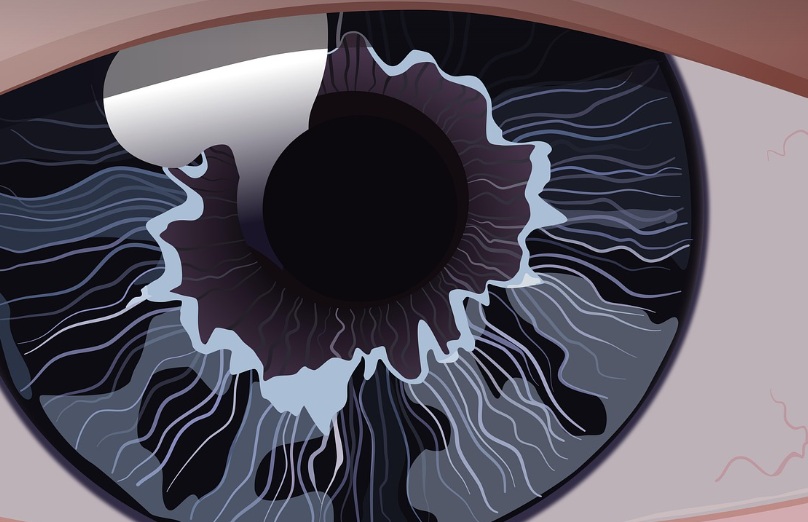 날파리증을 설명하는 눈