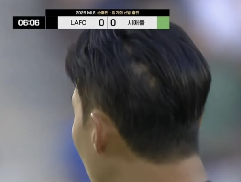 손흥민 탈모 해명: LAFC 15도움 스탯 진실과 월드컵 최다골 신기록 전망