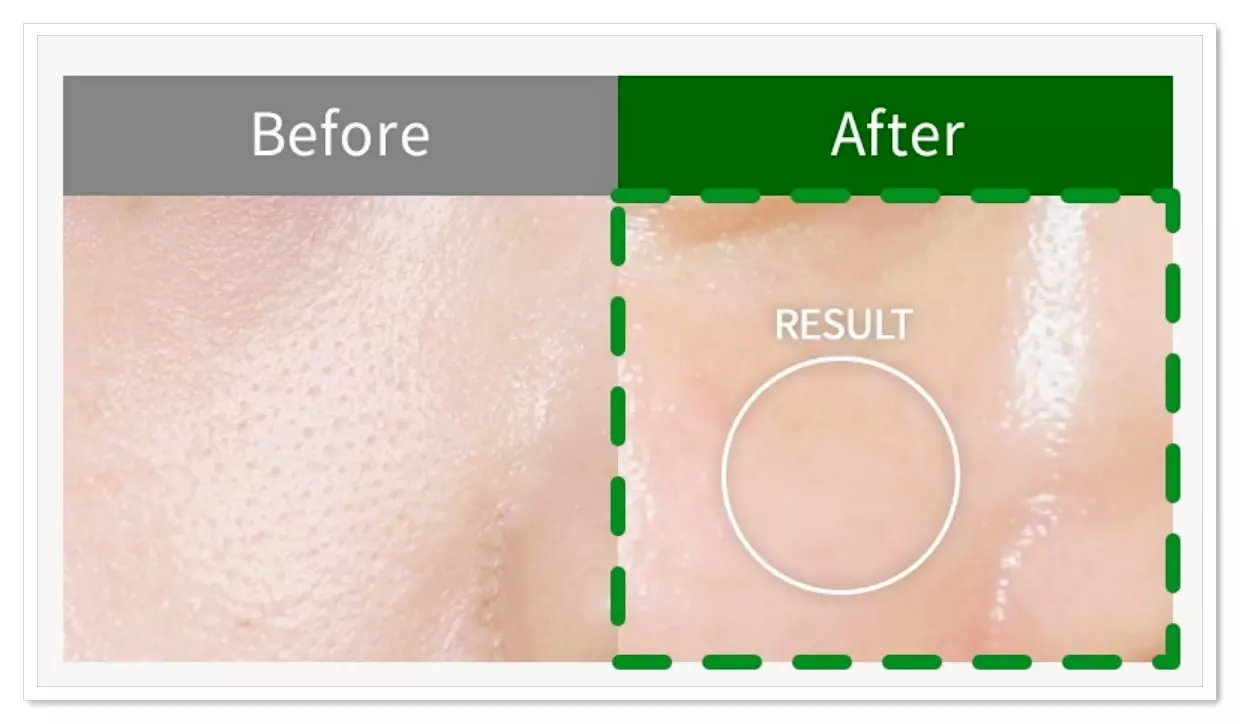 비쏠르 동안크림 매끈한 요철 축소