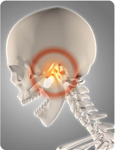 갑상선 기능 항진증에 대해 설명하는 그림
