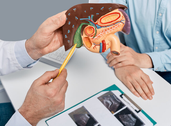 담낭결석 증상, 원인, 치료방법 총정리