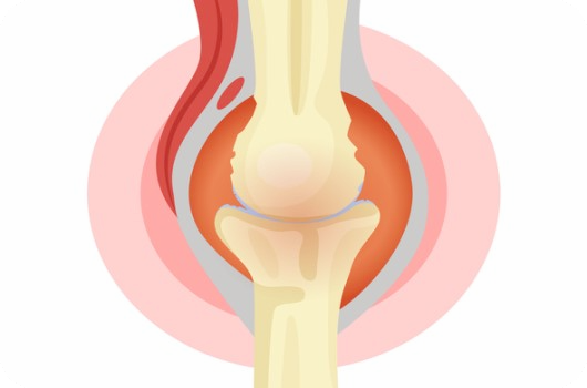 마그네슘-부족현상